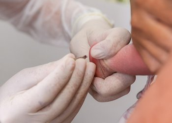 A principal forma de identificar a existência da condição é o conhecido Teste do Pezinho