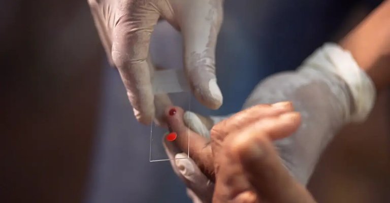 |  TV Brasil/Reprodução