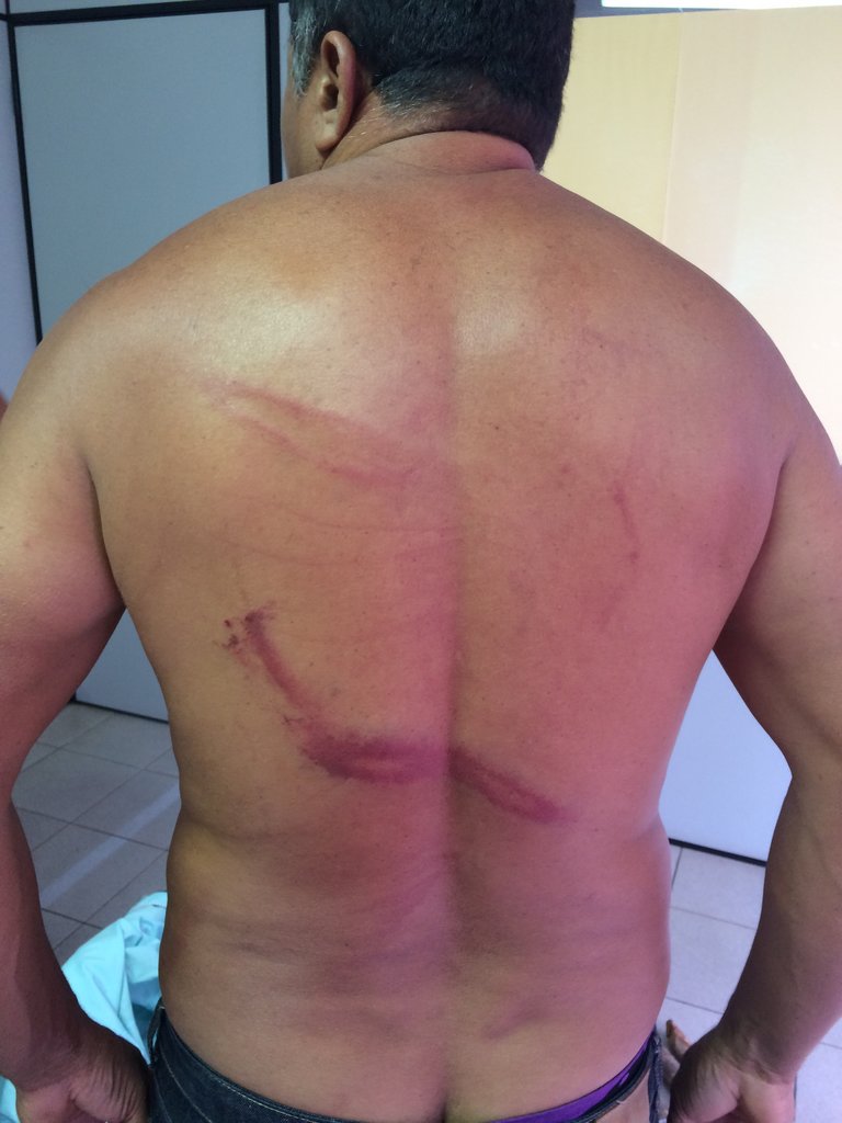 Moradores de Araguatins denunciaram ter sofrido tortura de policiais 